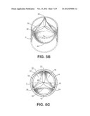 PROSTHETIC TISSUE VALVE diagram and image