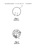 INTRAOCULAR CAPSULAR TENSION RINGS diagram and image