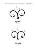 INTRAOCULAR CAPSULAR TENSION RINGS diagram and image