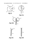 INTRAOCULAR CAPSULAR TENSION RINGS diagram and image