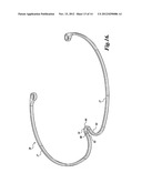 INTRAOCULAR CAPSULAR TENSION RINGS diagram and image