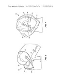 System and Method for Prosthetic Fitting and Balancing in Joints diagram and image