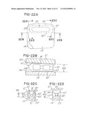 PROSTHETIC IMPLANT WITH BIPLANAR ANGULATION AND COMPOUND ANGLES diagram and image