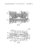 Transforaminal Prosthetic Spinal Disc Apparatus diagram and image