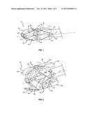MINIMALLY INVASIVE EXPANDING SPACER AND METHOD diagram and image