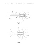 TISSUE PROSTHESIS AND A METHOD OF, AND EQUIPMENT FOR, FORMING A TISSUE     PROSTHESIS diagram and image