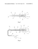 TISSUE PROSTHESIS AND A METHOD OF, AND EQUIPMENT FOR, FORMING A TISSUE     PROSTHESIS diagram and image