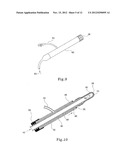 TISSUE PROSTHESIS AND A METHOD OF, AND EQUIPMENT FOR, FORMING A TISSUE     PROSTHESIS diagram and image