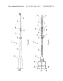 TISSUE PROSTHESIS AND A METHOD OF, AND EQUIPMENT FOR, FORMING A TISSUE     PROSTHESIS diagram and image