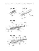 FLEXIBLE ELONGATED CHAIN IMPLANT AND METHOD OF SUPPORTING BODY TISSUE WITH     SAME diagram and image