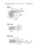 FLEXIBLE ELONGATED CHAIN IMPLANT AND METHOD OF SUPPORTING BODY TISSUE WITH     SAME diagram and image