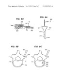 FLEXIBLE ELONGATED CHAIN IMPLANT AND METHOD OF SUPPORTING BODY TISSUE WITH     SAME diagram and image