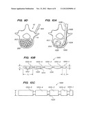 FLEXIBLE ELONGATED CHAIN IMPLANT AND METHOD OF SUPPORTING BODY TISSUE WITH     SAME diagram and image