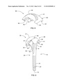 METHODS OF USING, PROVIDING AND MANUFACTURING A SHOULDER PROSTHESIS WITH A     ONE-PIECE HUMERAL HEAD diagram and image