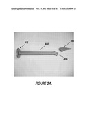 MINIMALLY INVASIVE SURGICAL TOOLS FOR HIP PROSTHESIS diagram and image