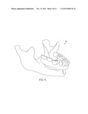 Method and system for forming a dental prosthesis diagram and image