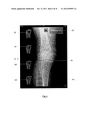 USER INTERFACE FOR MEDICAL DIAGNOSIS diagram and image