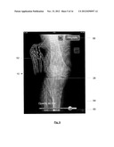 USER INTERFACE FOR MEDICAL DIAGNOSIS diagram and image