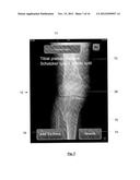 USER INTERFACE FOR MEDICAL DIAGNOSIS diagram and image