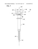 ANCHOR WITH ANGULAR ADJUSTMENT diagram and image