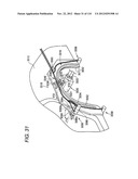 HEMMING WORKING METHOD AND WORKING APPARATUS diagram and image