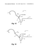 Container End Closure With Improved Chuck Wall and Countersink diagram and image