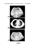 Multi-phase Gating for Radiation Treatment Delivery and Imaging diagram and image