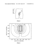 METHOD AND APPARATUS FOR IMAGING A SUBJECT USING LOCAL SURFACE COILS diagram and image