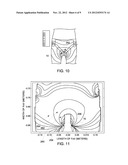 METHOD AND APPARATUS FOR IMAGING A SUBJECT USING LOCAL SURFACE COILS diagram and image