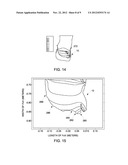 METHOD AND APPARATUS FOR IMAGING A SUBJECT USING LOCAL SURFACE COILS diagram and image