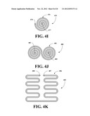 LIQUID NITROGEN COOLED MRI COILS AND COIL ARRAYS diagram and image