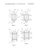 SURGE ARRESTER diagram and image