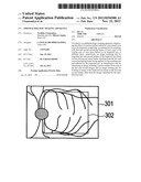 OPHTHALMOLOGIC IMAGING APPARATUS diagram and image