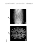 SYSTEMS, METHODS AND COMPUTER READABLE STORAGE MEDIUMS STORING     INSTRUCTIONS FOR APPLYING MULTISCALE BILATERAL FILTERING TO MAGNETIC     RESONANCE (RI) IMAGES diagram and image