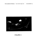 LIQUID RADIATION CURABLE RESINS CAPABLE OF CURING INTO LAYERS WITH     SELECTIVE VISUAL EFFECTS AND METHODS FOR THE USE THEREOF diagram and image