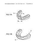 THERAPEUTIC DENTAL MOUTHPIECE-FORMING SUBSTRATE  AND PREFORMING METHOD     THEREOF diagram and image