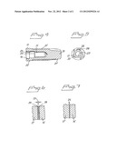 IMPLANT ARRANGEMENT WITH AN INTERNAL SOCKET FOR A TURNING TOOL diagram and image