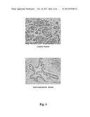 SEROLOGICAL MARKER FOR DETECTING PANCREATIC CANCER AND A METHOD FOR USING     THE SEROLOGICAL MARKER diagram and image