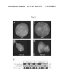 RECURRENT GENE FUSIONS IN PROSTATE CANCER diagram and image