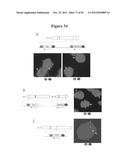 RECURRENT GENE FUSIONS IN PROSTATE CANCER diagram and image