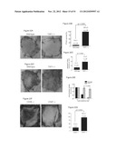 PREVENTION OF TISSUE ISCHEMIA AND RELATED COMPOSITIONS diagram and image