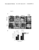 PREVENTION OF TISSUE ISCHEMIA AND RELATED COMPOSITIONS diagram and image