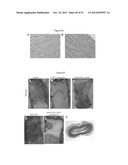 PREVENTION OF TISSUE ISCHEMIA AND RELATED COMPOSITIONS diagram and image