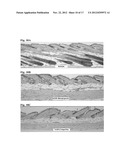 Ester Derivatives of Bimatoprost Compositions and Methods diagram and image