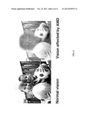 USE OF SULINDAC FOR PROTECTING RETINAL PIGMENT EPITHELIAL CELLS AGAINST     OXIDATIVE STRESS diagram and image