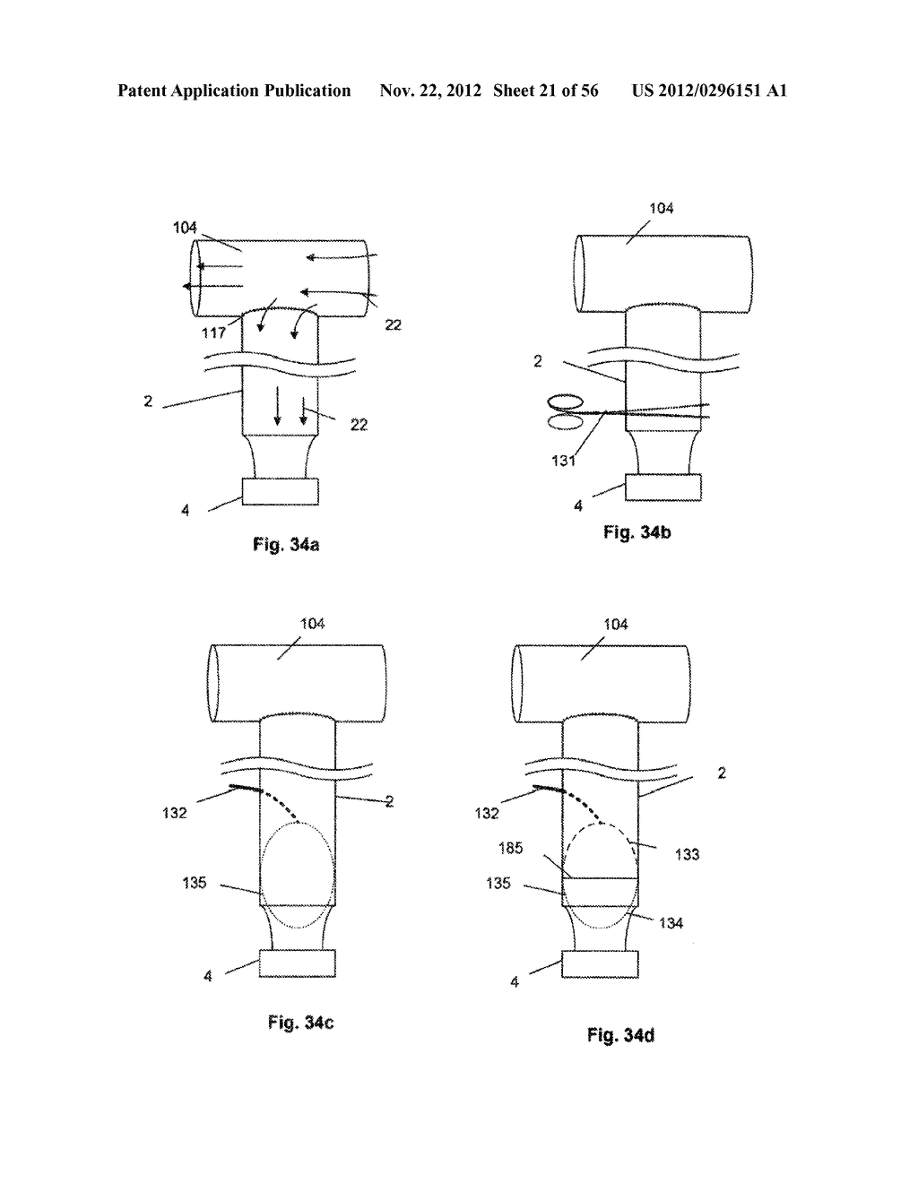 ASSEMBLY AND METHOD OF IMPLANTING A HEART ASSIST SYSTEM - diagram, schematic, and image 22