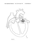 Positioning Cage diagram and image