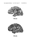 METHOD AND SYSTEM FOR DETERMINING A CONDITION OF A BRAIN diagram and image