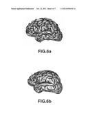 METHOD AND SYSTEM FOR DETERMINING A CONDITION OF A BRAIN diagram and image