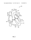 Electro-myocardial cardiogram (EmCG) Parameter s CSS/RSS for calculating     heart performance diagram and image